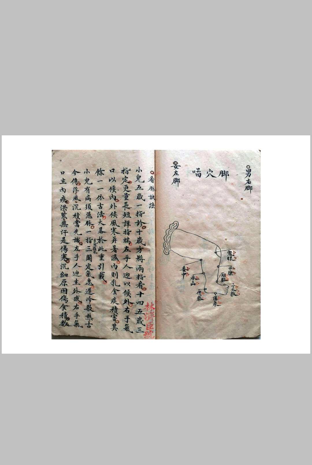图片[11]-中华古籍网-专注古书收集《祖传小儿科神火经纹秘诀》-中华古籍网-专注古书收集中华古籍网-专注古书收集