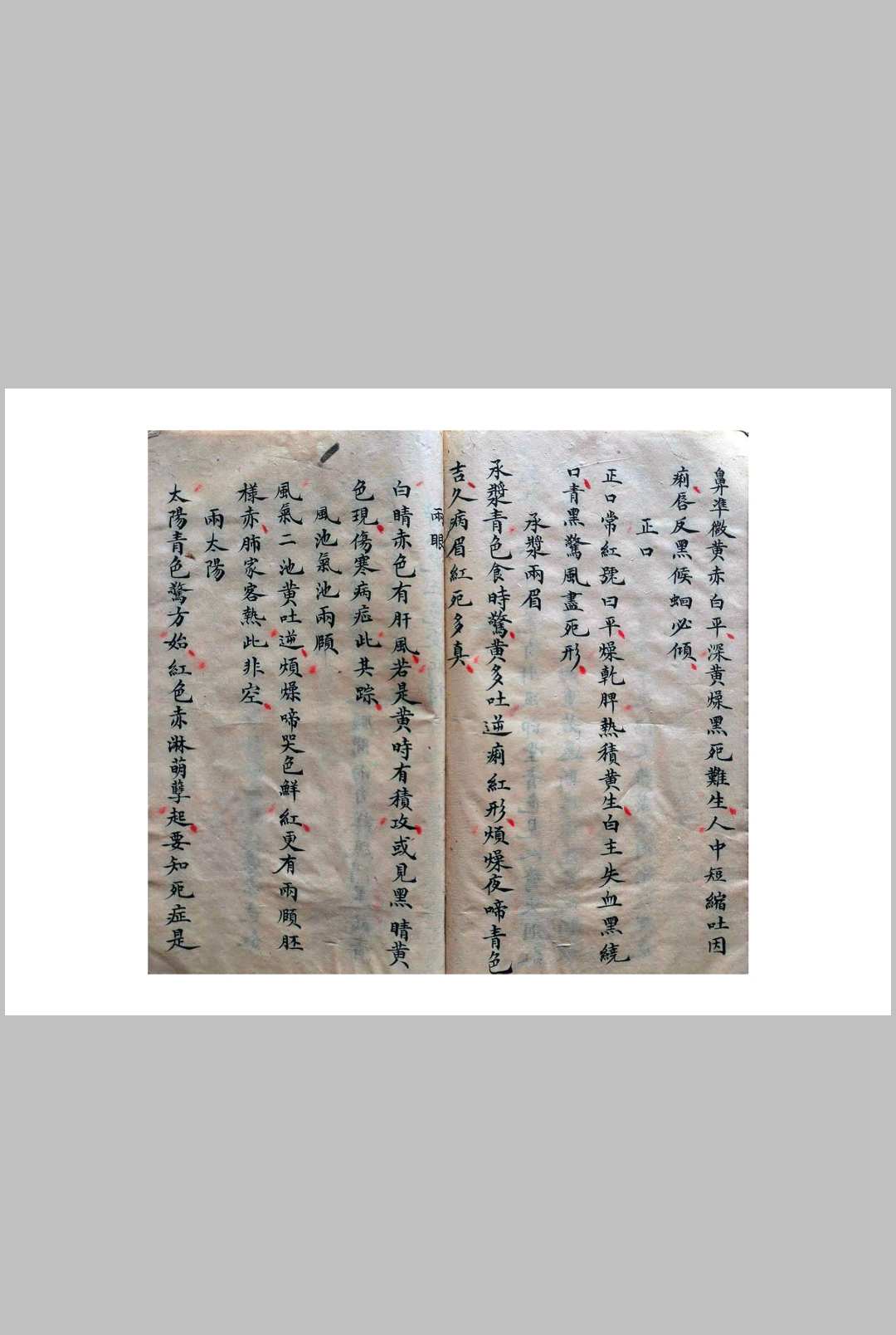 图片[17]-中华古籍网-专注古书收集《祖传小儿科神火经纹秘诀》-中华古籍网-专注古书收集中华古籍网-专注古书收集