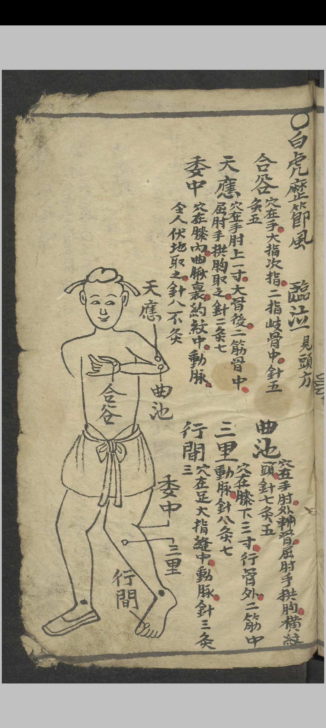 图片[2]-中华古籍网-专注古书收集绘图手抄医书 , 1900-中华古籍网-专注古书收集中华古籍网-专注古书收集