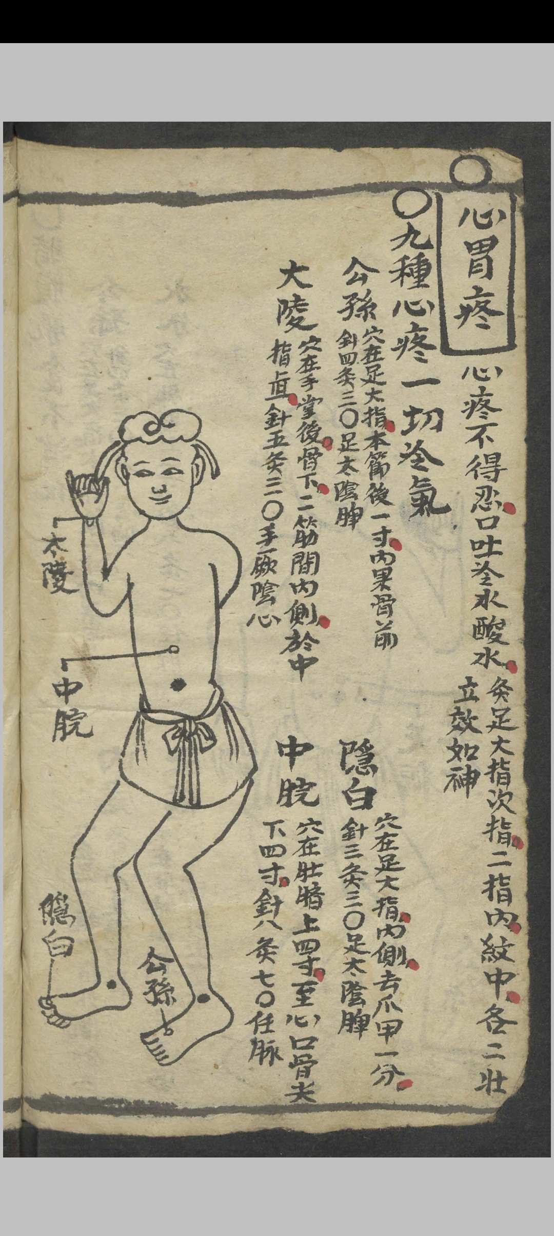 图片[4]-中华古籍网-专注古书收集绘图手抄医书 , 1900-中华古籍网-专注古书收集中华古籍网-专注古书收集