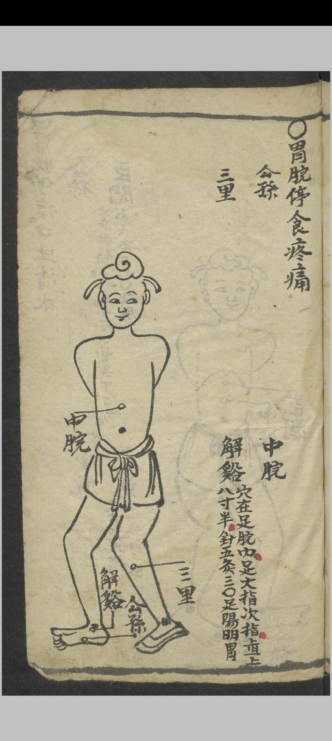 图片[13]-中华古籍网-专注古书收集绘图手抄医书 , 1900-中华古籍网-专注古书收集中华古籍网-专注古书收集