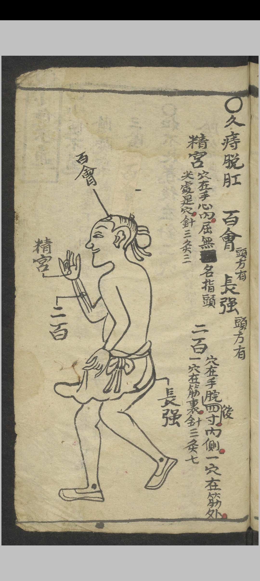 图片[12]-中华古籍网-专注古书收集绘图手抄医书 , 1900-中华古籍网-专注古书收集中华古籍网-专注古书收集