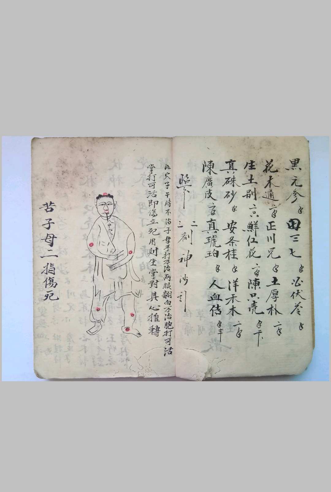 图片[4]-中华古籍网-专注古书收集《秘传看伤治而不治之症》-中华古籍网-专注古书收集中华古籍网-专注古书收集
