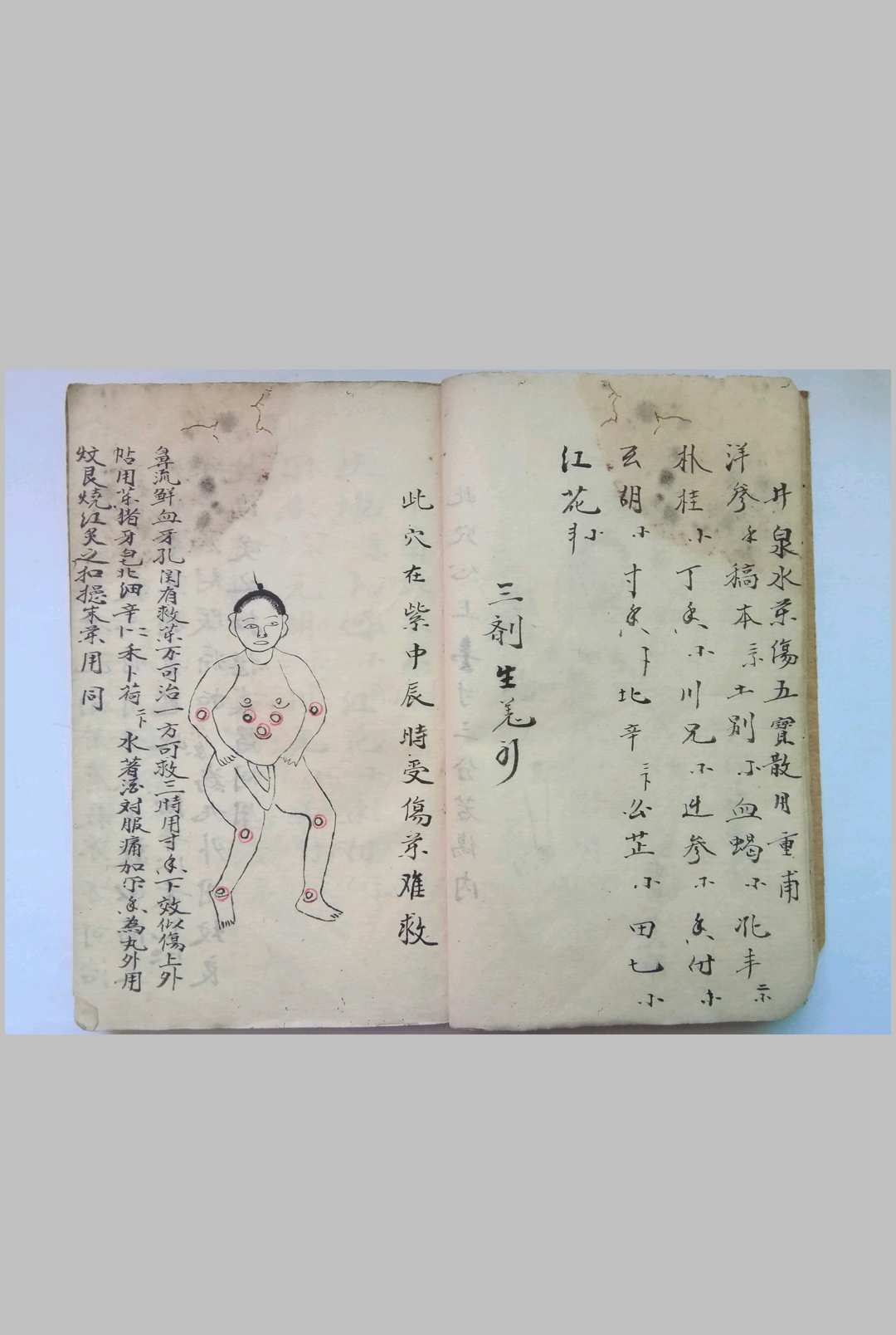 图片[6]-中华古籍网-专注古书收集《秘传看伤治而不治之症》-中华古籍网-专注古书收集中华古籍网-专注古书收集