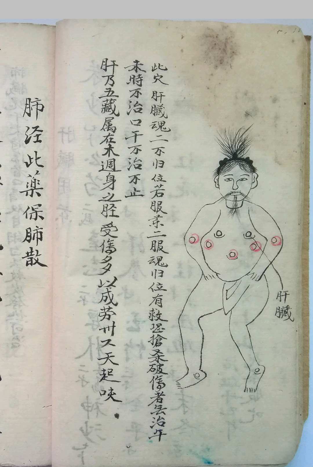 图片[9]-中华古籍网-专注古书收集《秘传看伤治而不治之症》-中华古籍网-专注古书收集中华古籍网-专注古书收集