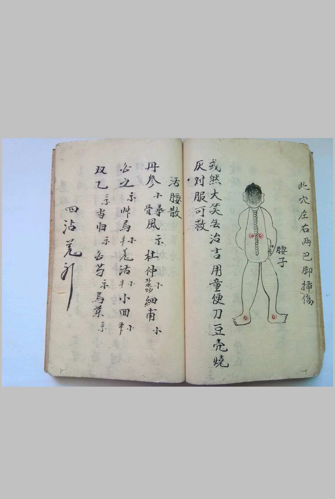 图片[12]-中华古籍网-专注古书收集《秘传看伤治而不治之症》-中华古籍网-专注古书收集中华古籍网-专注古书收集