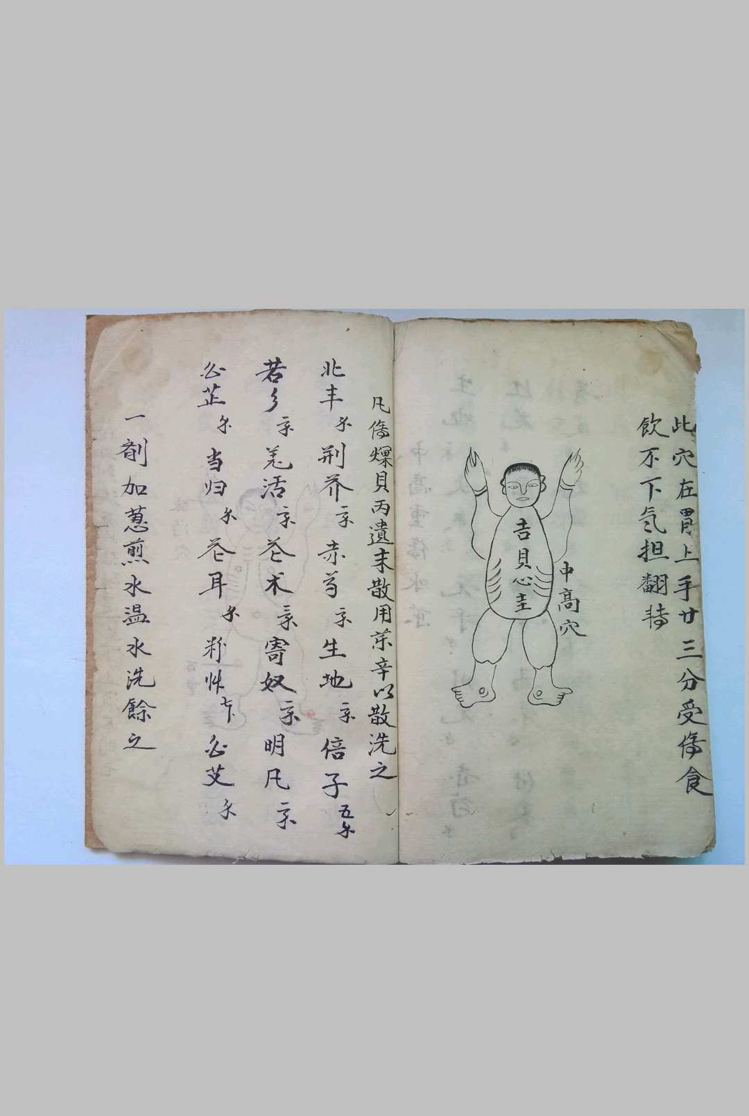 图片[15]-中华古籍网-专注古书收集《秘传看伤治而不治之症》-中华古籍网-专注古书收集中华古籍网-专注古书收集